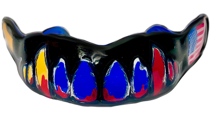 CUSTOM MOUTHGUARD